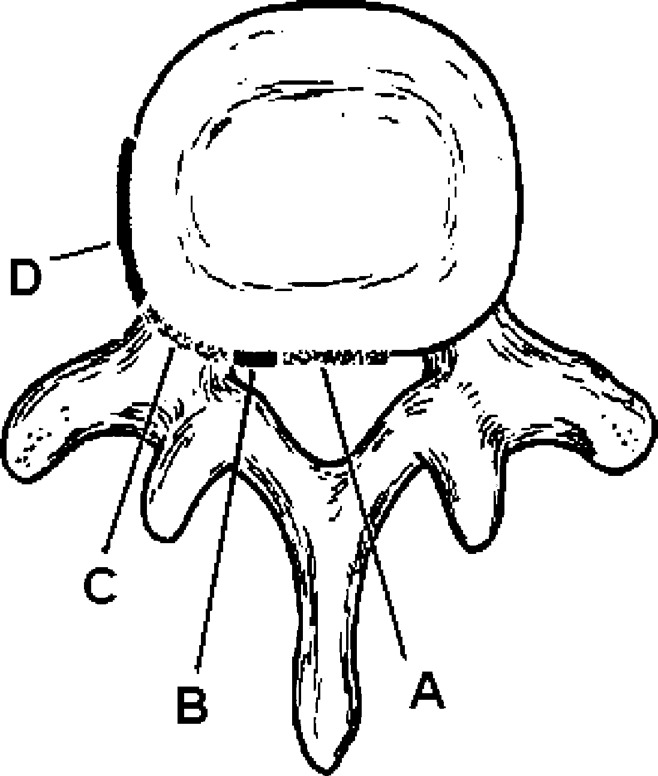 spine prot