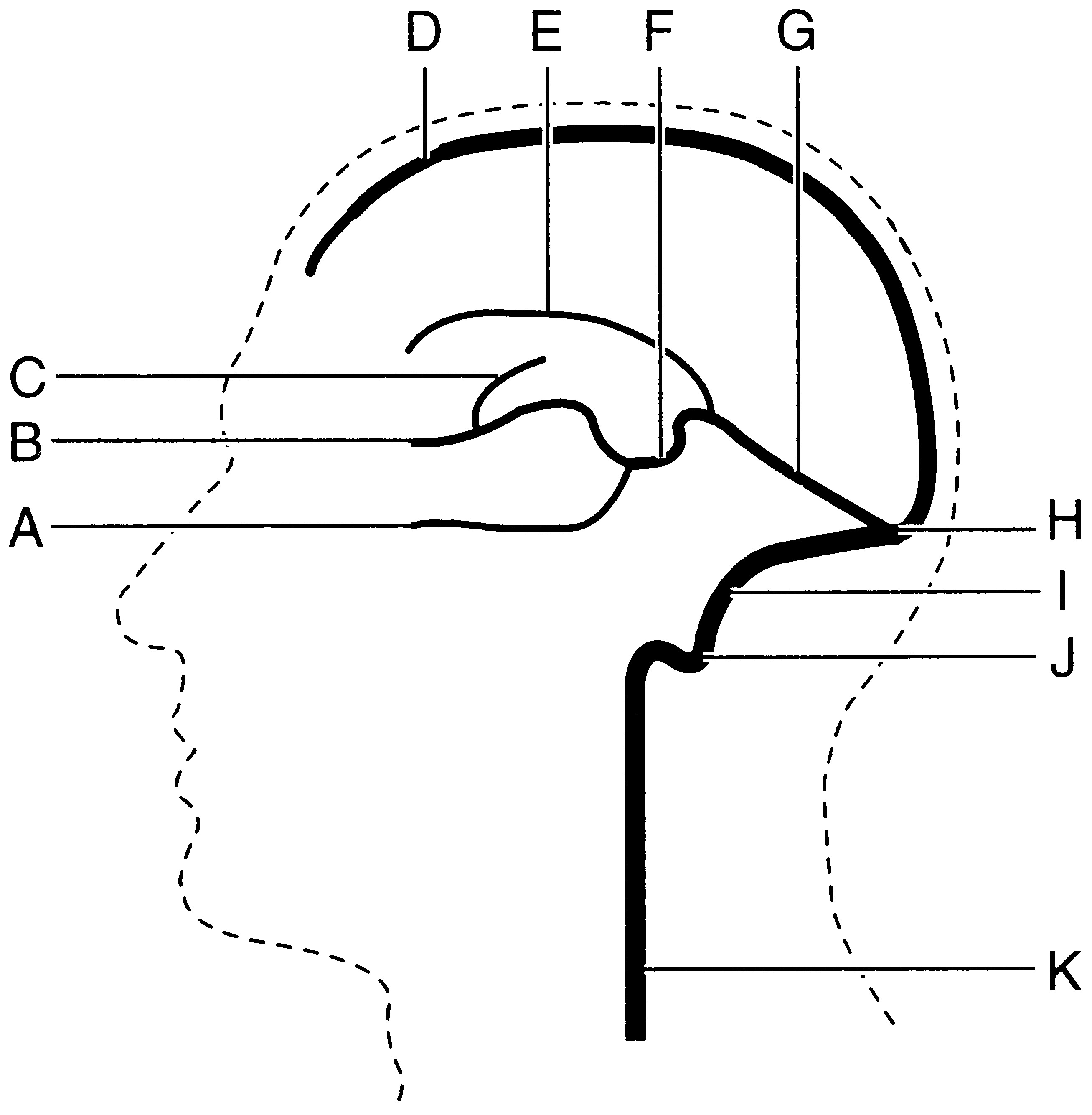 venous