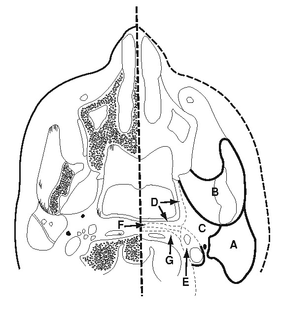 para