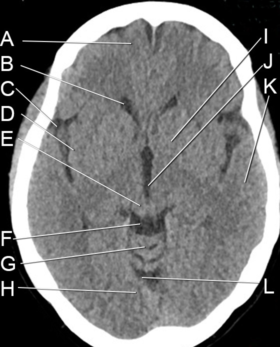 ct4