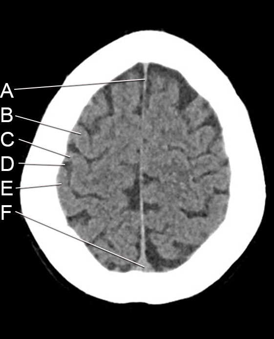 CT8