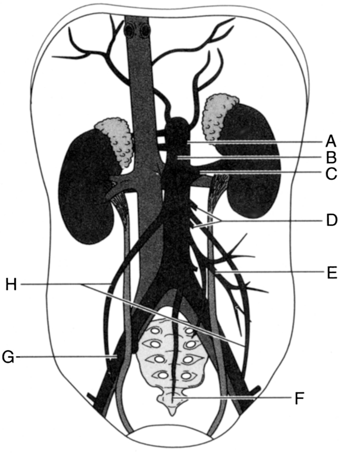 3_4a